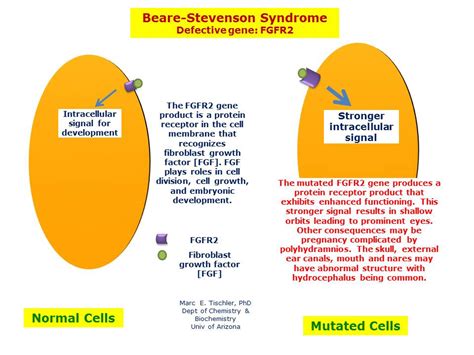 Beare Stevenson Syndrome Hereditary Ocular Diseases