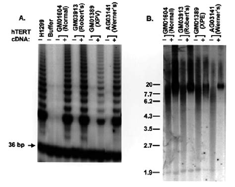 Telomerase Activity And Telomere Length In The Control And