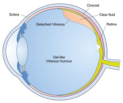 Retina And Vitreous New Al Shefa Clinic