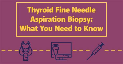 Thyroid Fine Needle Aspiration Biopsy What You Need To Know Uva