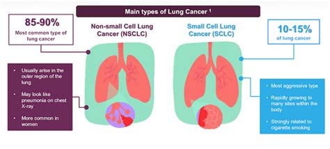 Treatment Of Non Small Cell Lung Cancer Nsclc In Stages Index China