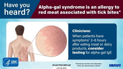 Health Care Provider Knowledge Regarding Alpha Gal Syndrome — United