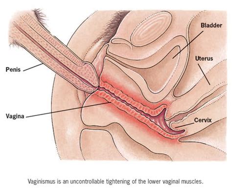Virgin Vagina Before And After
