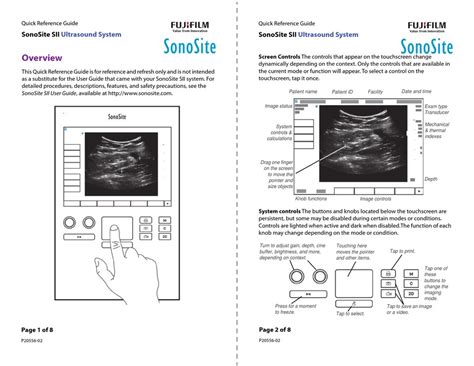 Fujifilm Sonosite Sii Quick Reference Manual Pdf Download Manualslib