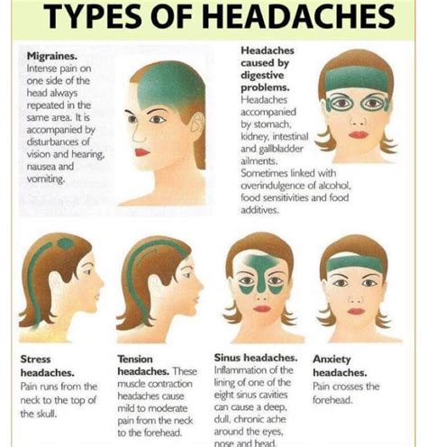 Migraines Remedies Health Remedies Headache Remedies