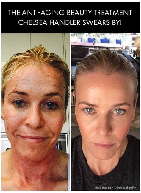 Chelsea Handler Then And Now Chelsea Handler On Twitter Special Shout
