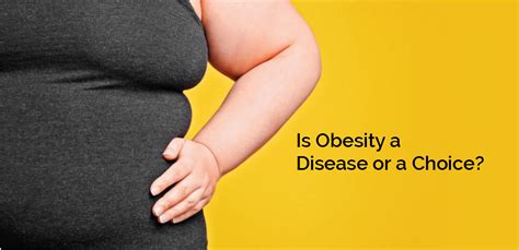 Is Obesity A Disease Or A Choice Nh Assurance