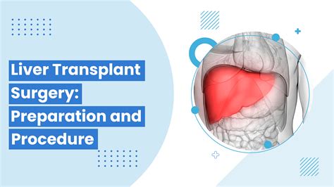 Liver Transplant Surgery Preparation And Procedure
