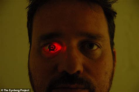 Eyeborg Filmmaker Has A Video Camera In His Prosthetic Eye That Can