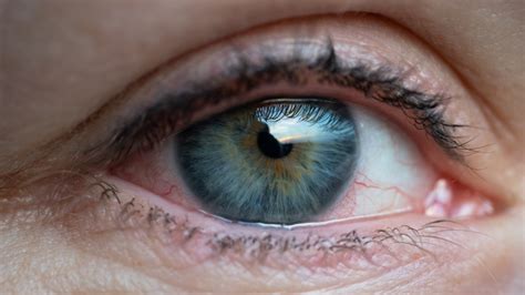 Gene Therapy Developed To Target Eye Disease