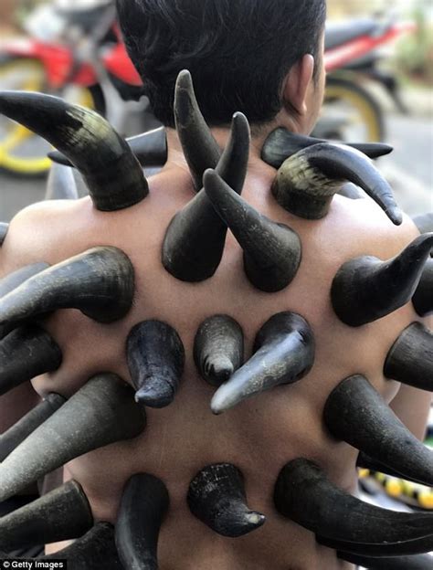Indonesian Healers Using Buffalo Horns For Cupping Therapy Daily Mail