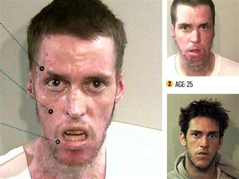 Meth Before And After Pics 2020