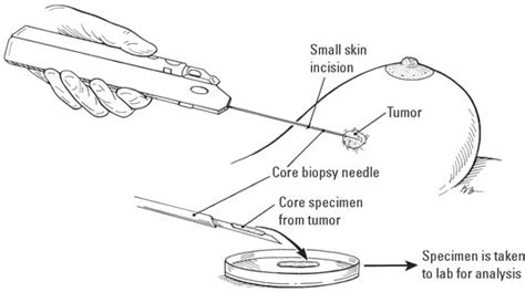 How To Choose A Breast Biopsy Type Dummies