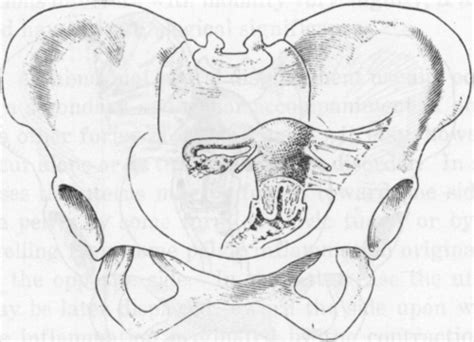 Uterus Side View Diagram