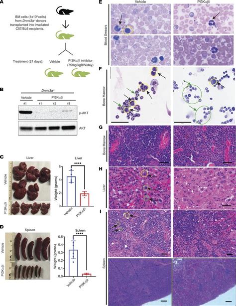 Jci Insight Loss Of Dnmt A Impairs Hematopoietic Homeostasis And