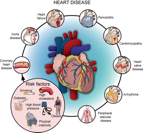 Heart Failure Risk Factors