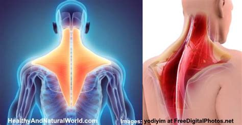 Trapezius Strain Causes And Treatments For Trapezius Muscle Pain