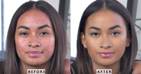 This Fenty Beauty Acne Tutorial Shows How To Cover Acne With Makeup