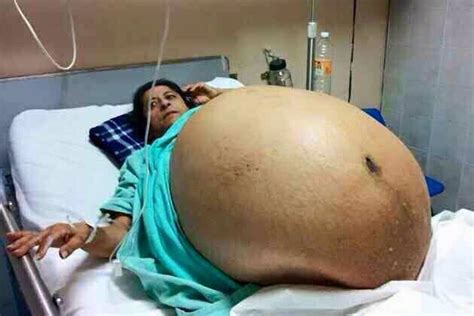 Pprevealing The Truth The Story Of A Woman Giving Birth To 11