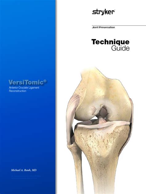 Acl Technique Guide Pdf Knee Orthopedic Surgery