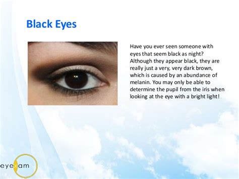 Black People With Rare Eye Color Eye Color Photos