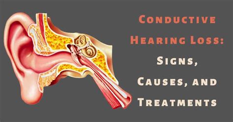 Conductive Hearing Loss Signs Causes And Treatments Desert Valley