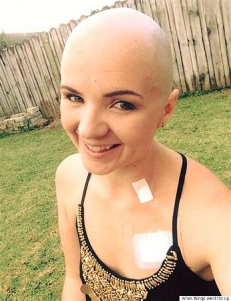 Breast Cancer Patient Throws A Shave My Head Party To