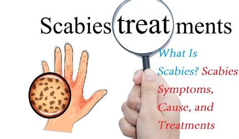 What Is Scabies Health Tips Medical Research Health