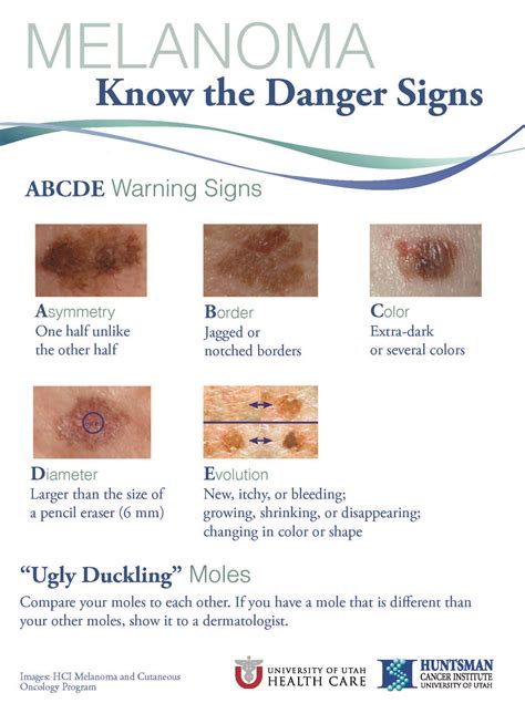 Warning Signs Of Skin Cancer
