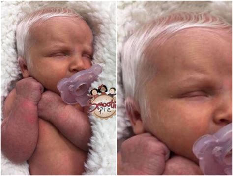 Photo Baby Born With White Hair Mojidelanocom