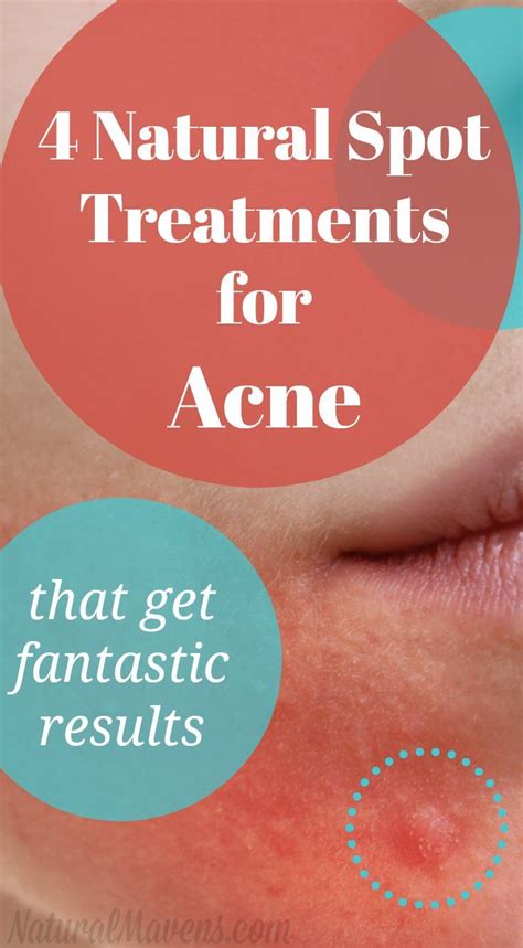 4 Natural Spot Treatments For Acne That Get Fantastic Results Natural