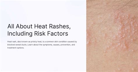 All About Heat Rashes Including Risk Factors