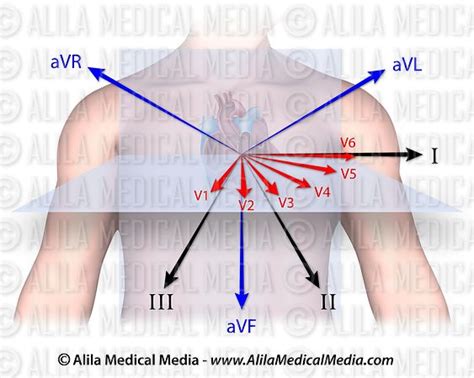 Alila Medical Media 12 Lead Ecg Medical Illustration