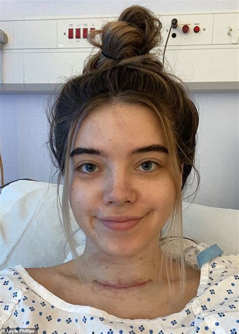 Student 22 Who Thought She Had Mumps Actually Had Thyroid Cancer