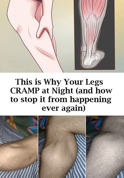 This Is Why Your Legs CRAMP At Night And How To Stop It From Happening Ever Again Leg Cramps