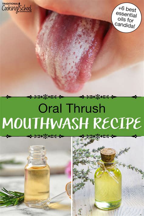 6 Essential Oils For Candida Oral Thrush Mouthwash Recipe