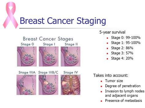 Breast Cancer Symptoms Review