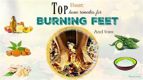 Top 14 Best Home Remedies For Burning Feet And Toes