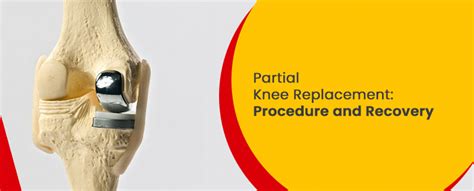 Partial Knee Replacement Surgery In Hyderabad Germanten Hospital