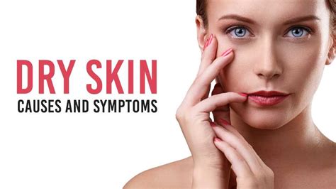 Dry Skin Causes And Symptoms Vince Care