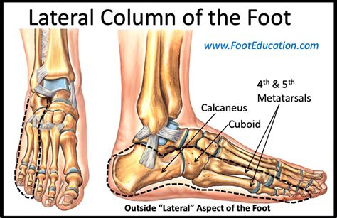 Lateral Column Lengthening Footeducation