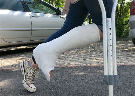 Lower Short Leg Plaster Cast With Heel Slwc Plastertesters Info