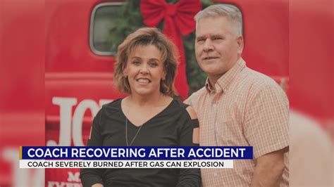 Tn Coach Recovering After Being Severely Burned In Accident Wkrn News 2
