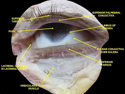 Lacrimal Caruncle Anatomy Reference Forensics Anatomy