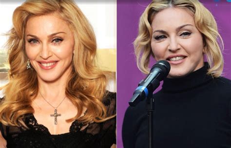 Madonna Plastic Surgery Before And After Face Photos