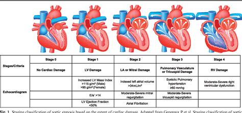 Aortic Stenosis Stages