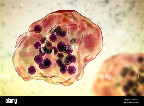 Warthin Finkeldey Giant Cells Hi Res Stock Photography And Images Alamy