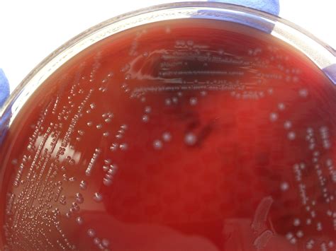 Enterococcus Faecalis Bacteriologia Microbiología Microorganismos