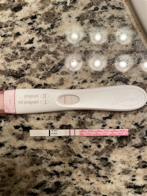 Got My Dye Stealers On Both Frer And Easyhome Today Hcg Was 1405