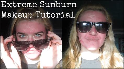 Extreme Sunburn Makeup Tutorial Youtube